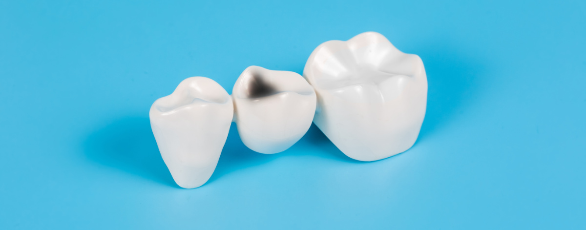 Stomatologia zachowawcza